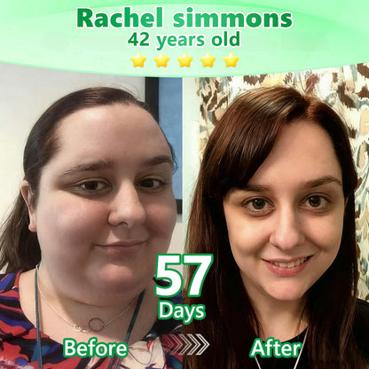 👑𝐎𝐟𝐟𝐢𝐜𝐢𝐚𝐥 Ireland 𝐂𝐞𝐫𝐭𝐢𝐟𝐢𝐞𝐝👨‍⚕️𝐋𝐨𝐭𝐦𝐚𝐲® GLP-1 6-in-1 Oral Liquid  Supports weight management, heart & vascular health, blood sugar balance, sleep quality, joint flexibility, and overall wellbeing